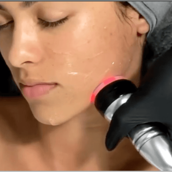Tone & Sculpt Facial- 18 Treatments at Selah Day Spa & Wellness in Livingston, TX