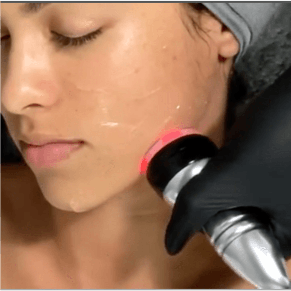 Tone & Sculpt Facial- 12 Treatments at Selah Day Spa & Wellness in Livingston, TX